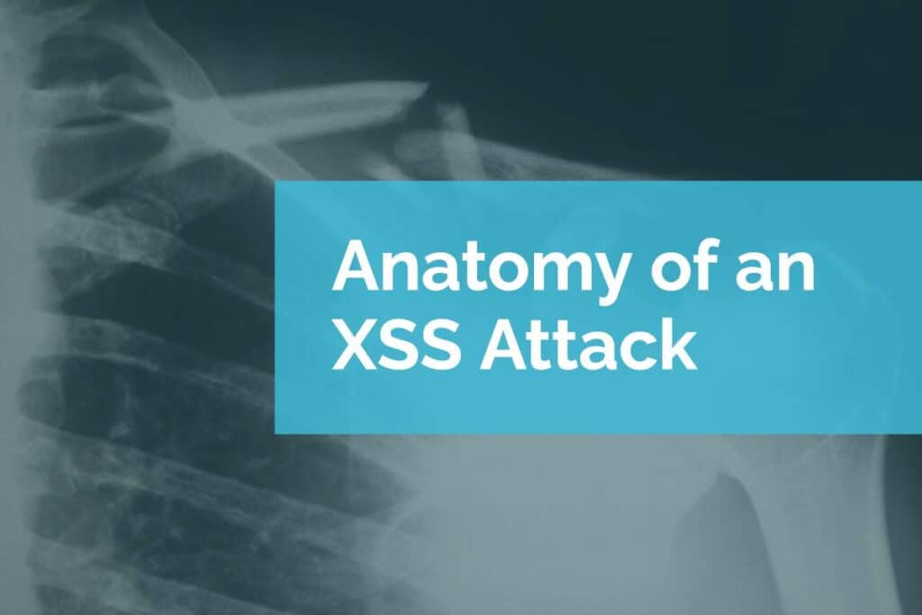 Anatomy of an XSS Attack Anatomy of an XSS Attack