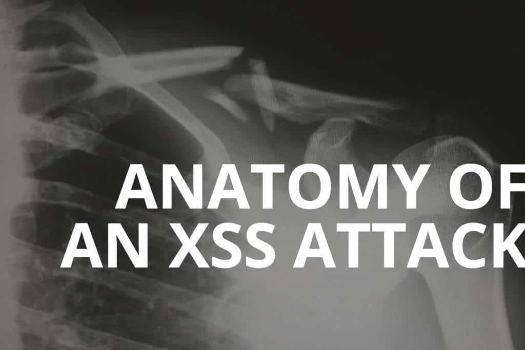 anatomy of an XSS attack